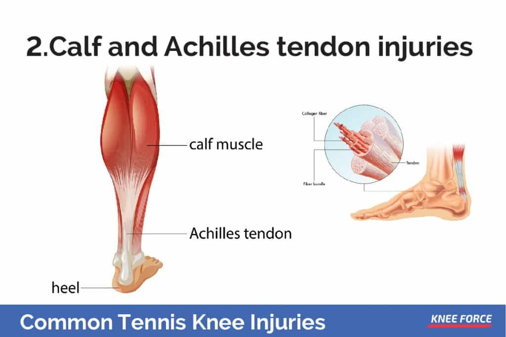 Common Tennis Knee Injuries And How To Prevent Them | Knee Force