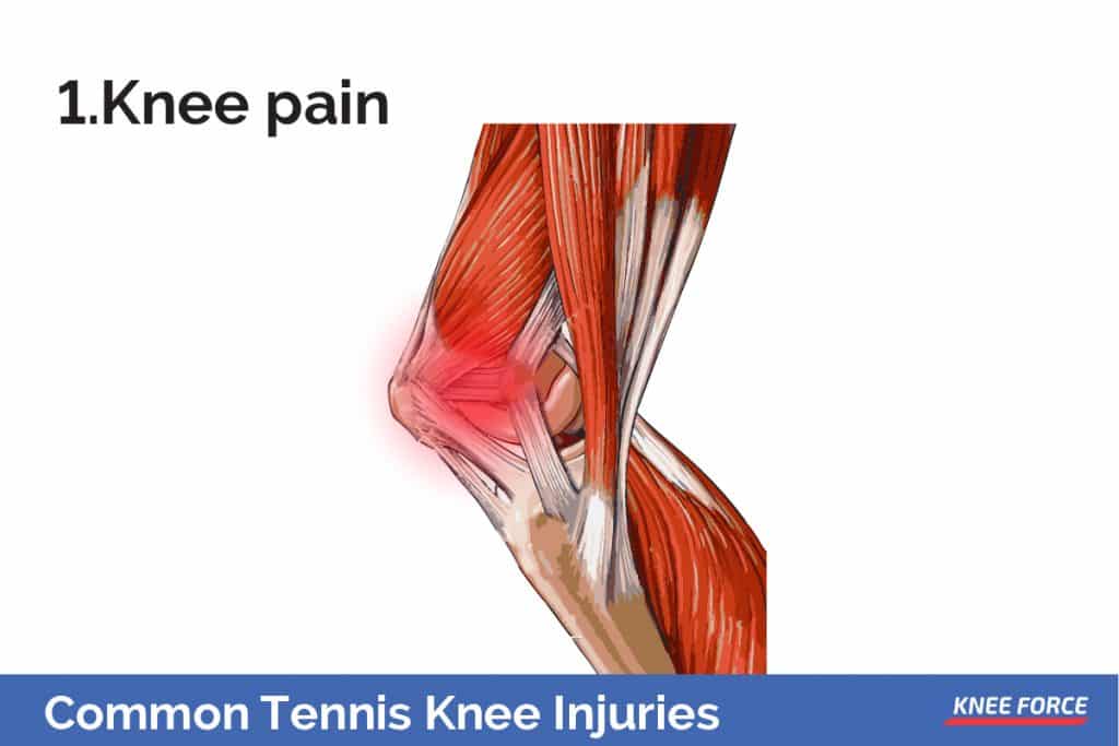 Common Tennis Knee Injuries And How To Prevent Them | Knee Force