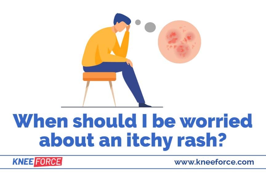 Itchy Rash From A Knee Brace › Knee Force