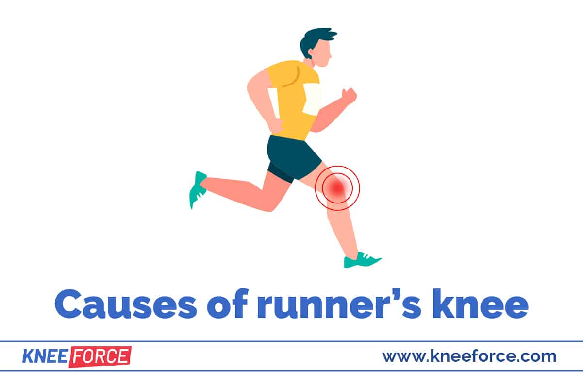 What Is Runner's Knee? › Knee Force