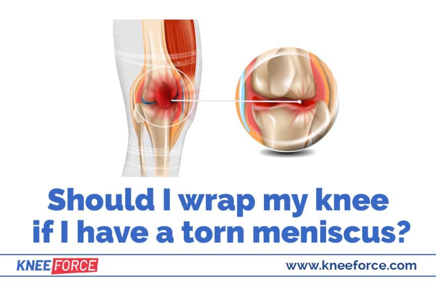 How To Wrap A Knee With A Torn Meniscus › Knee Force